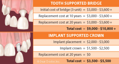 Dental Implants - Mooresville