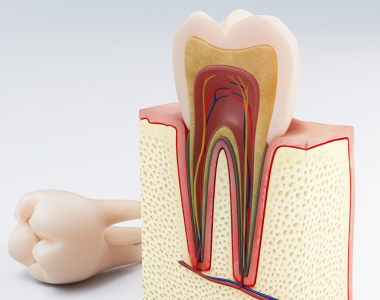 Understanding Tooth Sensitivity: Causes and Treatments- treatment at Mooresville dental care 